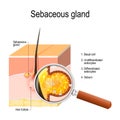 Structure of the Sebaceous gland.