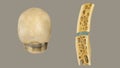 Structure of skull bone