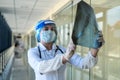 Student intern in a protective suit and face shield looks at a xray film of the lungs, covid19