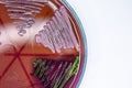 Study Colony characteristic of Actinomyces, Bacteria, yeast and Mold on selective media from soil samples.