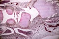 Study Histology of human, tissue bone under the microscopic. Royalty Free Stock Photo