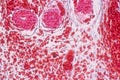 Study Histology of human, tissue bone under the microscopic.