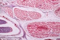 Study Histology of human, tissue bone under the microscopic.