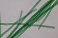 Oscillatoria is a genus of filamentous cyanobacterium, oscillation in its movement under the microscope.