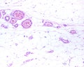 Subcutaneous adipose tissue. Blood vessels