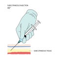 Subcutaneous injection. Effective methods of administration of drugs and other medical solutions that are used for humans.