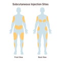 Subcutaneous injection sites. Medicine injection sites on the human body