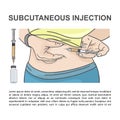 SUBCUTANEOUS INJECTION In Stomach Medical Vector Illustration