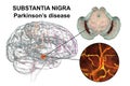 Substantia nigra, a basal banglia of the midbrain, in Parkinson's disease