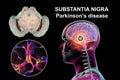 Substantia nigra, a basal banglia of the midbrain, in Parkinson's disease, 3D illustration
