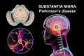 Substantia nigra, a basal banglia of the midbrain, in Parkinson's disease, 3D illustration Royalty Free Stock Photo