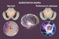 Substantia nigra of the midbrain and its dopaminergic neurons in normal state and in Parkinson's disease, 3D