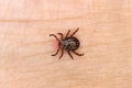 sucking tick, sucking on human. Tick on the skin background. Dermacentor reticulatus