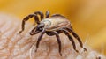 Sucking tick Macro photo on human skin. Ixodes ricinus. Bloated parasite bitten into pink irritated epidermis. Small red Royalty Free Stock Photo