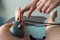 Suction cups applied to a knee in physiotherapy Royalty Free Stock Photo