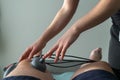 Suction cups applied to a knee in physiotherapy Royalty Free Stock Photo