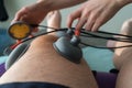 Suction cups applied to a knee in physiotherapy