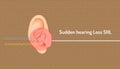 Sudden hearing loss shl red dangerous circle symbol mean a signal is wave line into an ear but can not hear  is direct line. body Royalty Free Stock Photo