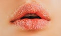 Sugar lips. Closeup lip with sugar. Beauty treatments. Lipscare cosmetics.