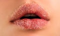 Sugar lips. Closeup lip with sugar. Beauty treatments. Lipscare cosmetics.