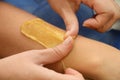 Sugaring epilation