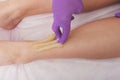 Sugaring epilation skin care with liquid sugar at legs. Royalty Free Stock Photo