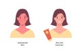 Summer skin care and sunscreen protection concept. Vector flat people illustration. Compare of woman with unprotected skin tan and