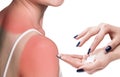 Sunblock on the shoulder of a young woman Royalty Free Stock Photo