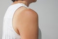 The sunburn shoulder female skin Royalty Free Stock Photo