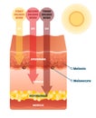 Sunburn skin damage anatomical cross section diagram