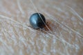 Super close up macro of blood filled black dark grey colored male tick Ixodes ricinus Royalty Free Stock Photo