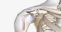 A superior labral tear is when a lesion is found in the upper portion for the labrum