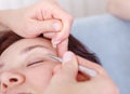 Surgeon applies a bandage to the female patient`s eyelids after Royalty Free Stock Photo