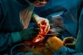 Surgeon doctor close up hands of open heart of surgeons Royalty Free Stock Photo