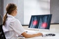 Surgeon Doctor Looking At Knee Xray Bone Scan Royalty Free Stock Photo