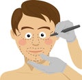 Surgeon drawing marks on male face. Plastic surgery concept Royalty Free Stock Photo