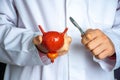 Surgeon held scalpel over anatomical model of human bladder prostate, holding it in his hand against background of body in uniform