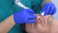 Surgeon making laser removal of papillomas on man eyes skin, face closeup.