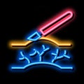 surgery treatment varicose veins neon glow icon illustration