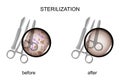 Surgical instruments before and after sterilization