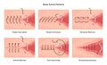 Surgical stitches patterns. Stitching methods and shapes. Tissues and skin