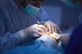 Surgical team performing surgery in modern operation theater,Team of doctors concentrating on a patient during a surgery