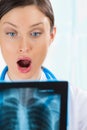 Surprised and very excited female doctor looking at a lungs x-ray