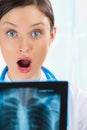 Surprised and very excited female doctor looking at x-ray