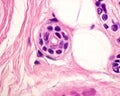Sweat gland. Intradermal duct Royalty Free Stock Photo