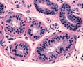 Sweat gland. Secretory unit. Royalty Free Stock Photo