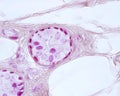 Eccrine sweat gland. Myoepithelial cells