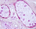 Eccrine sweat gland. Myoepithelial cells