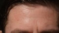 Sweating man forehead - Close up Royalty Free Stock Photo