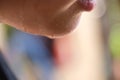 Sweaty face concept, Close up of woman with wet skin on chin Royalty Free Stock Photo